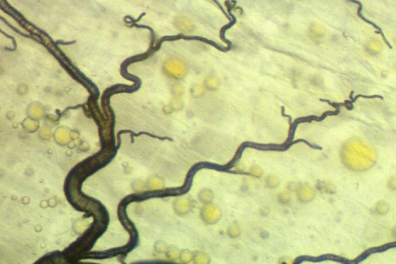 Les organes respiratoires - 6mn 00s